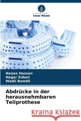 Abdrücke in der herausnehmbaren Teilprothese Hassen, Narjes, Zidani, Hager, Bembli, Wadii 9786208772994 Verlag Unser Wissen
