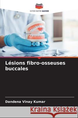 Lésions fibro-osseuses buccales Vinay Kumar, Dandena 9786208777142