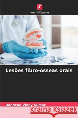 Lesões fibro-ósseas orais Vinay Kumar, Dandena 9786208777173