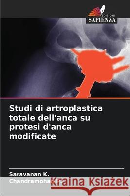 Studi di artroplastica totale dell'anca su protesi d'anca modificate K., Saravanan, P., Chandramohan 9786208778521