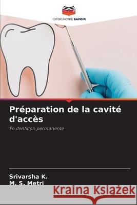Préparation de la cavité d'accès K., Srivarsha, Metri, M. S. 9786208782788 Editions Notre Savoir