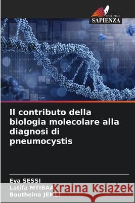 Il contributo della biologia molecolare alla diagnosi di pneumocystis SESSI, Eya, Mtibaa, Latifa, Jemli, Boutheina 9786208786885