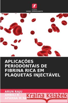 APLICAÇÕES PERIODONTAIS DE FIBRINA RICA EM PLAQUETAS INJECTÁVEL Raju, Arun, R, Ambili, M Nair, Aparna 9786208794132