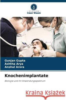 Knochenimplantate Gupta, Gunjan, Arya, Ashtha, Arora, Anshul 9786208799731