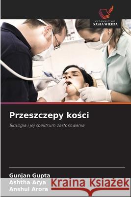 Przeszczepy kosci Gupta, Gunjan, Arya, Ashtha, Arora, Anshul 9786208799779