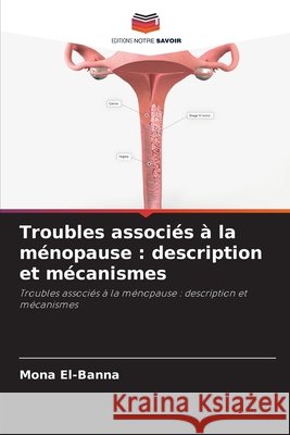 Troubles associés à la ménopause : description et mécanismes El-Banna, Mona 9786208802103 Editions Notre Savoir