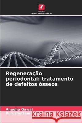 Regeneração periodontal: tratamento de defeitos ósseos Gawai, Anagha, Rakhewar, Purushottam 9786208808471