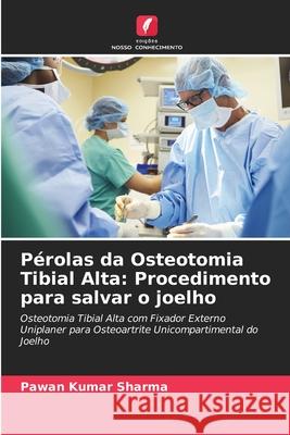 Pérolas da Osteotomia Tibial Alta: Procedimento para salvar o joelho Sharma, Pawan Kumar 9786208810702