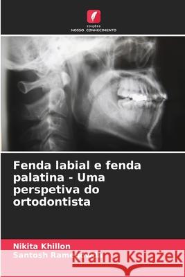 Fenda labial e fenda palatina - Uma perspetiva do ortodontista Khillon, Nikita, Ramegowda, Santosh 9786208816957 Edições Nosso Conhecimento