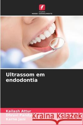 Ultrassom em endodontia Attur, Kailash, Pandya, Dhruvi, Jani, Karna 9786208817022
