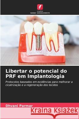Libertar o potencial do PRF em Implantologia Parmar, Dhvani 9786208817145