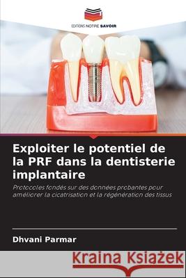 Exploiter le potentiel de la PRF dans la dentisterie implantaire Parmar, Dhvani 9786208817176