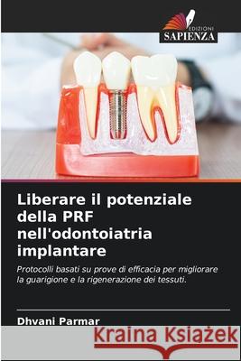 Liberare il potenziale della PRF nell'odontoiatria implantare Parmar, Dhvani 9786208817183