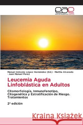 Leucemia Aguda Linfoblástica en Adultos López Hernández (Ed.), Manuel Antonio, Alvarado, Martha, Manuel Perez, Juan 9786208828516