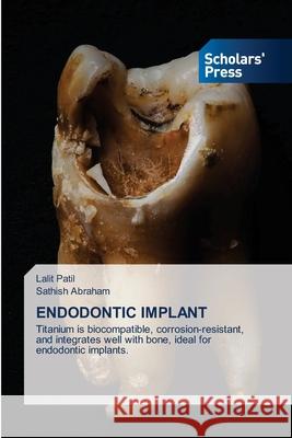 Endodontic Implant Lalit Patil Sathish Abraham 9786208848255 Scholars' Press