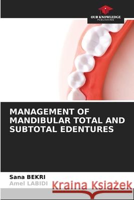 MANAGEMENT OF MANDIBULAR TOTAL AND SUBTOTAL EDENTURES Bekri, Sana, Labidi, Amel 9786208850227 Our Knowledge Publishing