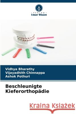 Beschleunigte Kieferorthopädie Bharathy, Vidhya, Chinnappa, Vijayadhith, POTHURI, ASHOK 9786208856014 Verlag Unser Wissen