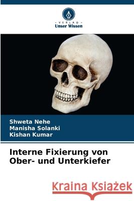 Interne Fixierung von Ober- und Unterkiefer Nehe, Shweta, Solanki, Manisha, Kumar, Kishan 9786208867072