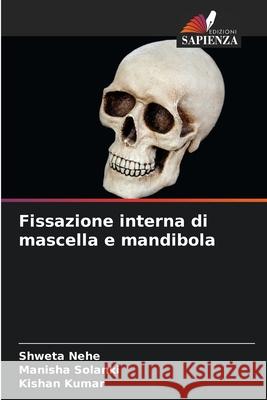 Fissazione interna di mascella e mandibola Nehe, Shweta, Solanki, Manisha, Kumar, Kishan 9786208867225