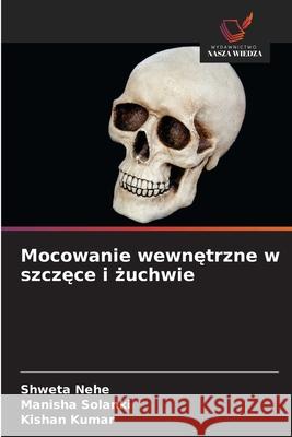 Mocowanie wewnetrzne w szczece i zuchwie Nehe, Shweta, Solanki, Manisha, Kumar, Kishan 9786208867232