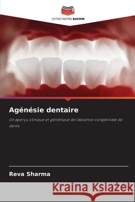 Agénésie dentaire Sharma, Reva 9786208868048