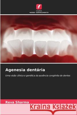 Agenesia dentária Sharma, Reva 9786208868079