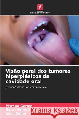 Visão geral dos tumores hiperplásicos da cavidade oral Garma, Maroua, Henteti, Hajer, Selmi, Jamil 9786208873103
