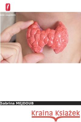 Determinação da tiroglobulina e dos anticorpos anti-tiroglobulina MEJDOUB, Sabrina 9786208873226