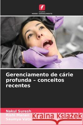 Gerenciamento de cárie profunda - conceitos recentes SURESH, NAKUL, Manan, Rishi, VATS, SAUMYA 9786208880576