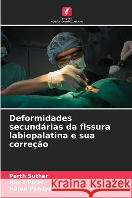 Deformidades secundárias da fissura labiopalatina e sua correção SUTHAR, PARTH, Patel, Hiren, PANDYA, HAREN 9786208880811