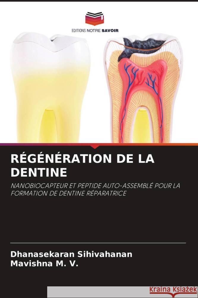 RÉGÉNÉRATION DE LA DENTINE Sihivahanan, Dhanasekaran, M. V., Mavishna 9786208881580