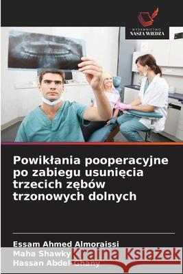 Powiklania pooperacyjne po zabiegu usuniecia trzecich zebów trzonowych dolnych Almoraissi, Essam Ahmed, Shawky, Maha, Abdel-Ghany, Hassan 9786208884581
