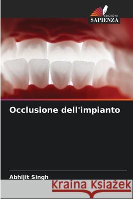 Occlusione dell'impianto Singh, Abhijit 9786208885151