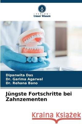 Jüngste Fortschritte bei Zahnzementen Das, Dipanwita, Agarwal, Dr. Garima, Bano, Dr. Rehana 9786208888329