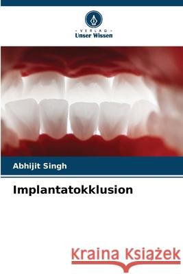 Implantatokklusion Singh, Abhijit 9786208898052