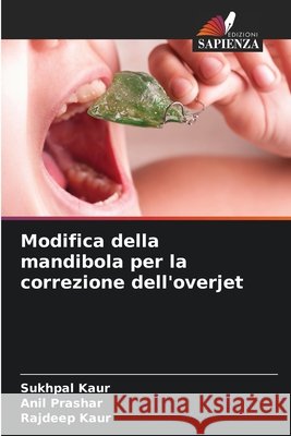 Modifica della mandibola per la correzione dell'overjet Kaur, Sukhpal, Prashar, Anil, Kaur, Rajdeep 9786208899202