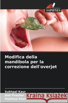 Modifica della mandibola per la correzione dell'overjet Kaur, Sukhpal, Prashar, Anil, Kaur, Rajdeep 9786208899202 Edizioni Sapienza
