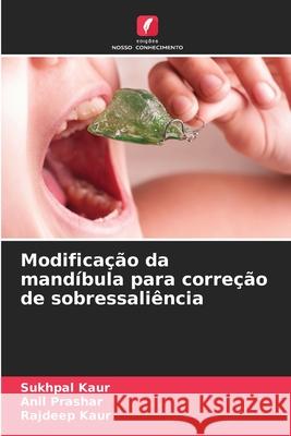 Modificação da mandíbula para correção de sobressaliência Kaur, Sukhpal, Prashar, Anil, Kaur, Rajdeep 9786208899233 Edições Nosso Conhecimento