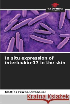 In situ expression of interleukin-17 in the skin Fischer-Stabauer, Mattias 9786208901219