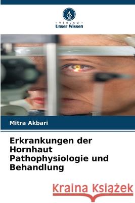 Erkrankungen der Hornhaut Pathophysiologie und Behandlung Akbari, Mitra 9786208906115