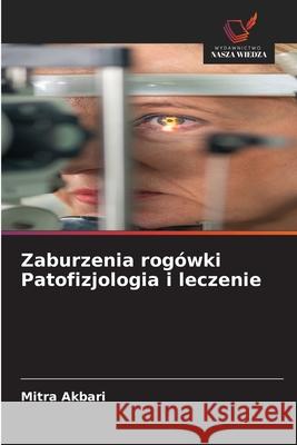 Zaburzenia rogówki Patofizjologia i leczenie Akbari, Mitra 9786208906153