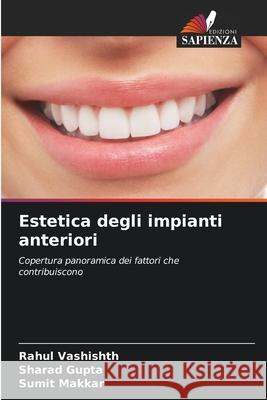 Estetica degli impianti anteriori Vashishth, Rahul, Gupta, Sharad, Makkar, Sumit 9786208917104