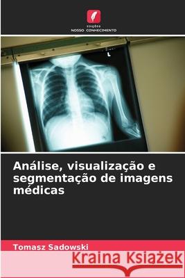 Análise, visualização e segmentação de imagens médicas Sadowski, Tomasz 9786208918903
