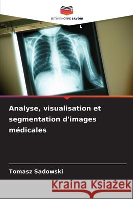 Analyse, visualisation et segmentation d'images médicales Sadowski, Tomasz 9786208918958