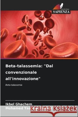 Beta-talassemia: 