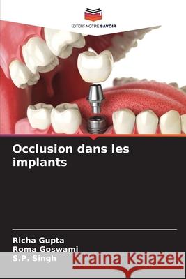 Occlusion dans les implants Gupta, Richa, Goswami, Roma, Singh, S. P. 9786208934644