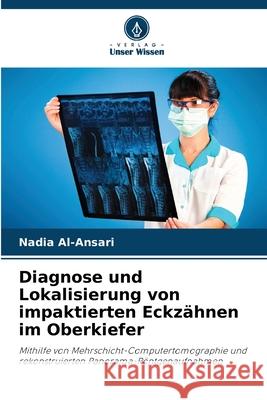 Diagnose und Lokalisierung von impaktierten Eckzähnen im Oberkiefer Al-Ansari, Nadia 9786208938758 Verlag Unser Wissen