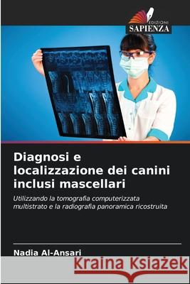 Diagnosi e localizzazione dei canini inclusi mascellari Al-Ansari, Nadia 9786208938789
