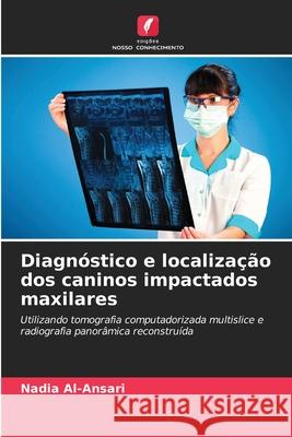 Diagn?stico e localiza??o dos caninos impactados maxilares Nadia Al-Ansari 9786208938796