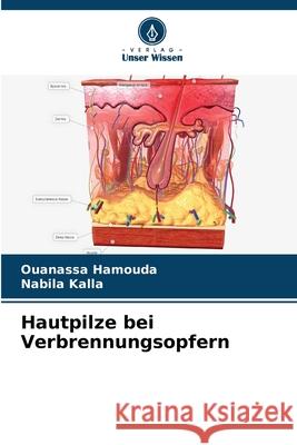 Hautpilze bei Verbrennungsopfern Hamouda, Ouanassa, Kalla, Nabila 9786208944216